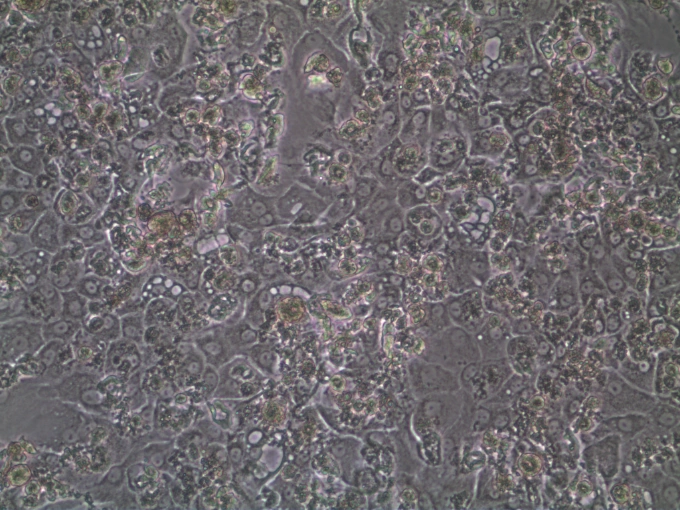 Culture progression on brightfield - Day 22