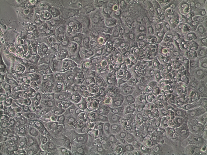 Culture progression on brightfield - Day 30
